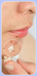 Acne Reset Ritual