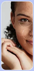 Pigmentation Correction